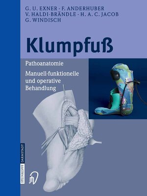 cover image of Klumpfuß